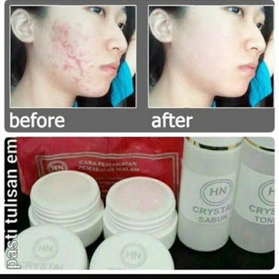 Jual Cream HN Crystal Original || 082137002573