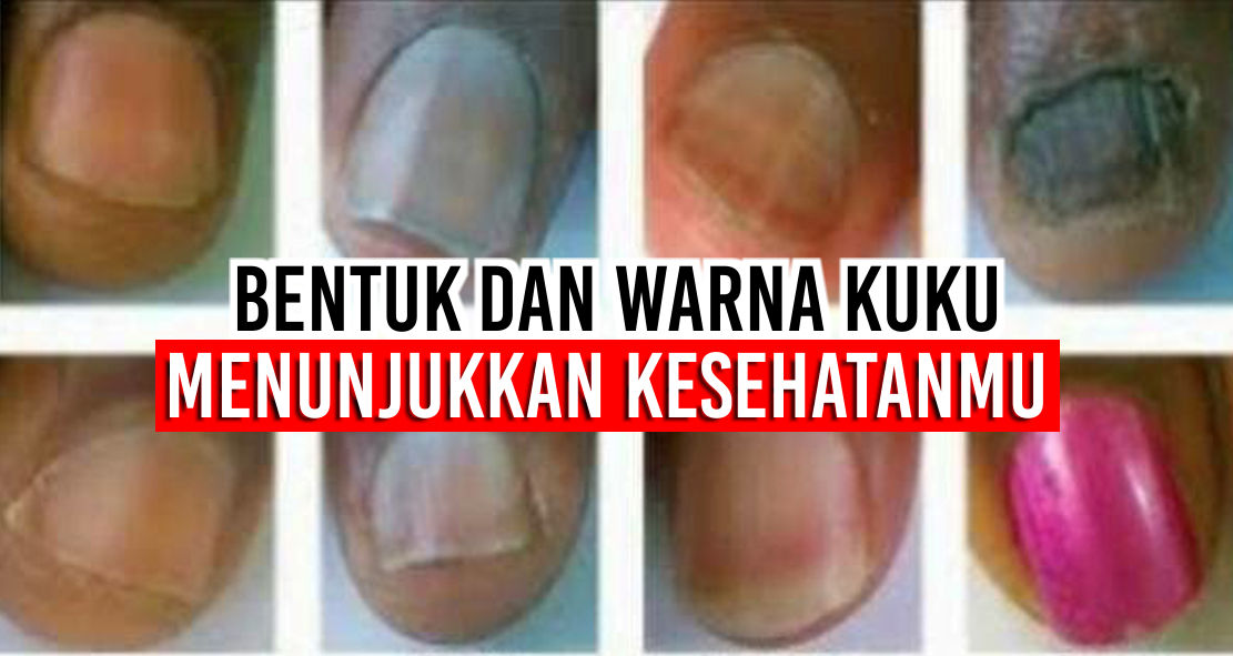 Ternyata Kamu Bisa Tahu Kesehatanmu Lewat Bentuk Dan Warna Kuku Lho !