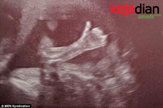 Unik Banget GAN, Bayi Dalam Kandungan Acungkan Jempol