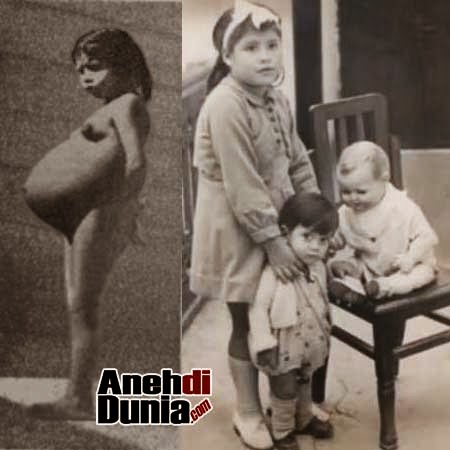 Ini dia gan Foto Anak-anak yang Hamil masih dibawah Umur