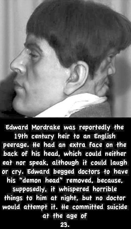 Kisah Urban Legend Edward Mordrake,Sosok Two Faces Dari Inggris Di Abad 19