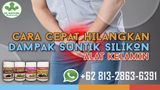 cara-mengecilkan-bengkak-kelamin-efek-suntik-minyak-kemiri-simak-disini