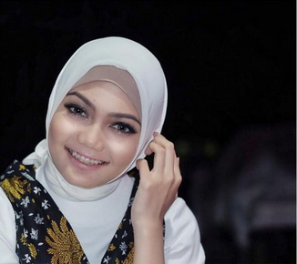9 Artis Ini Tetap Cantik Dan Menawan Meski Hidungnya Pesek 