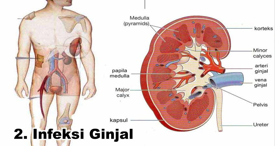  Ini Loh Bahayanya Menahan Buang Air Kecil ! 