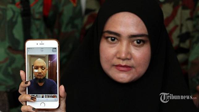 Pelaku Penyiraman Air Keras Ditangkap, Istri Novel Baswedan Justru Khawatir