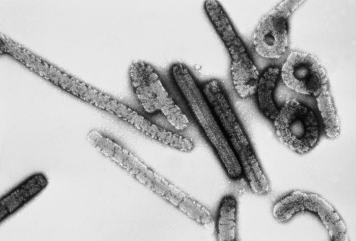 8 Virus Paling Berbahaya Di Dunia