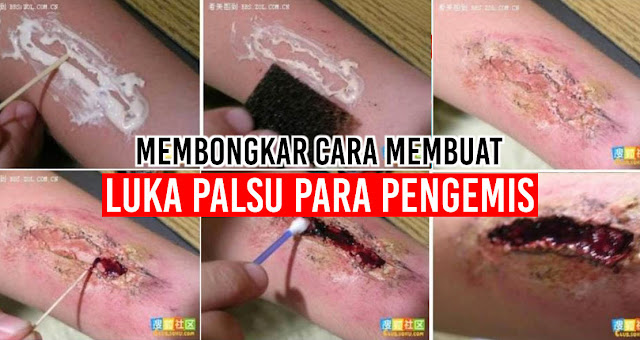 inilah-cara-pengemis-membuat-luka-palsu-pada-tubuh-mereka