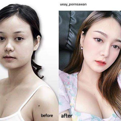 Transformasi Orang-Orang Thailand Jadi Cantik Ini Bikin Pangling! No. 9 Jantungan!