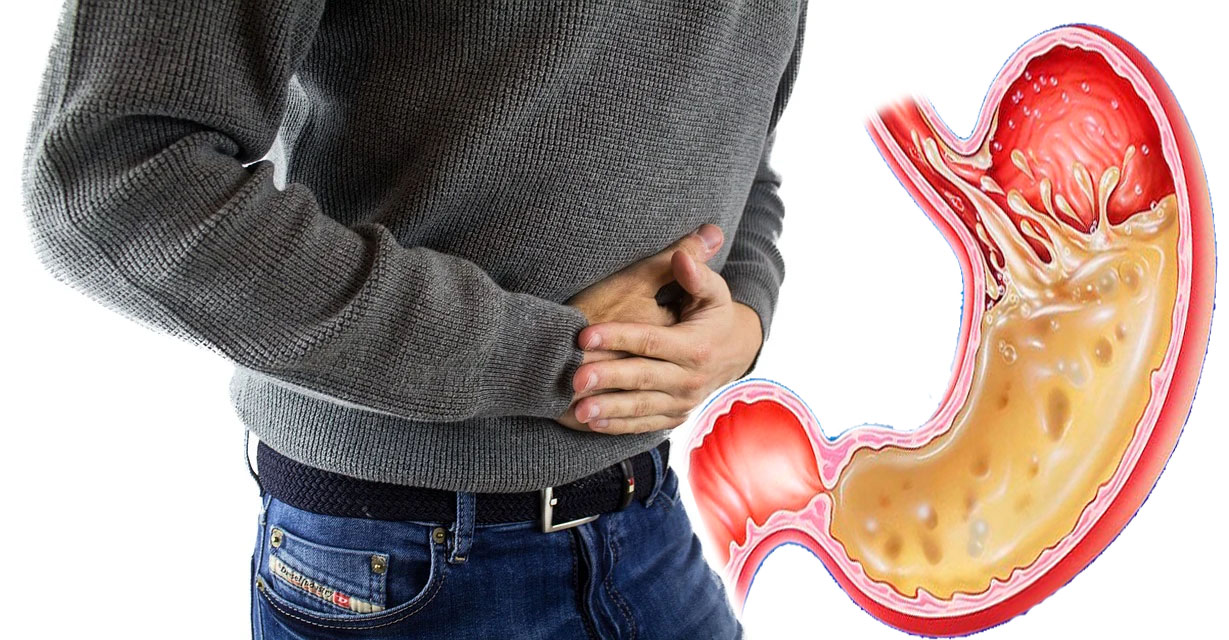 Tips Cara Menghindari dan Mengatasi Asam Lambung Naik