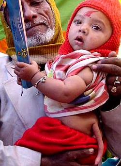 10 Bayi Paling Aneh Yang Pernah Terlahir di Dunia