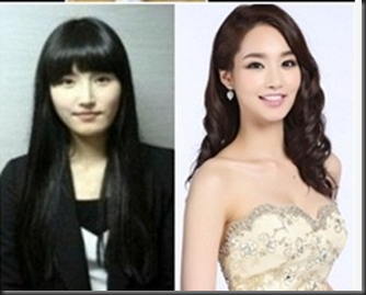 15 Artis Korea yang melakukan operasi plastik -
