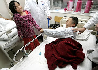 Qian Hongyan (Gadis Cacat yang Hebat) dari China