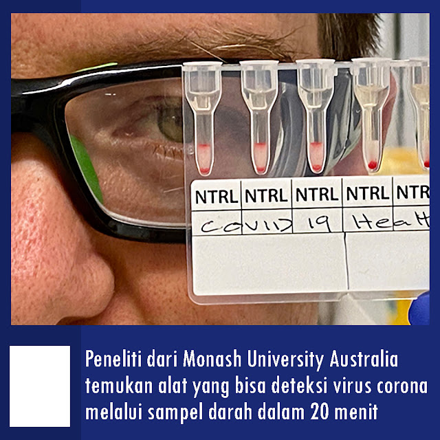 Tes Ini Diklaim Bisa Deteksi Corona Dalam 20 Menit