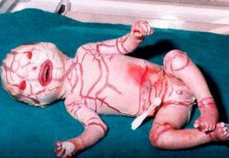 10 Bayi Paling Aneh Yang Pernah Terlahir di Dunia