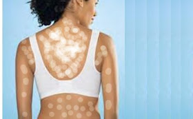 ini-die-bray-penyakit-yang-simpel-tapi-nyiksa-bray