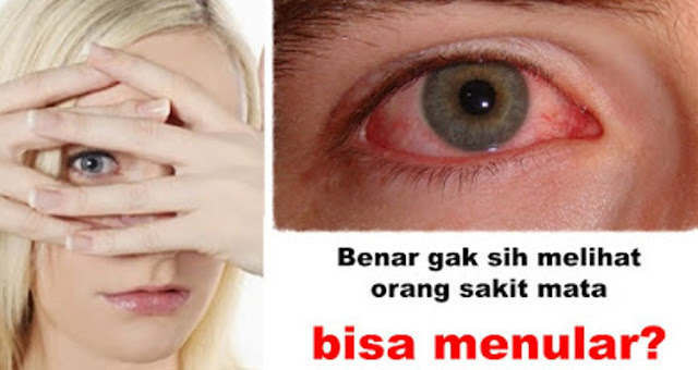 Sakit Mata Menular Lewat Pandangan, Mitos atau Fakta?
