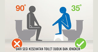 Kamu Pilih yang Mana, Toilet Duduk atau Jongkok?