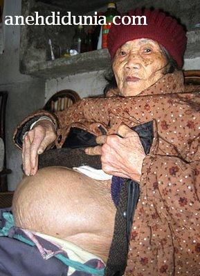Aneh Banget!! Nenek ini Melahirkan Bayi Mumi