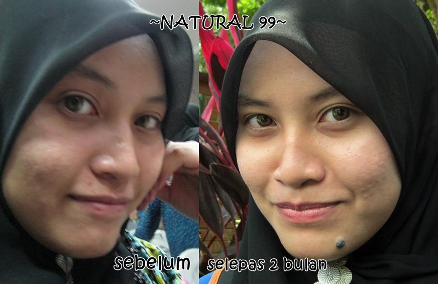 Harga Cream Natural 99 Asli Termurah || 082137002573