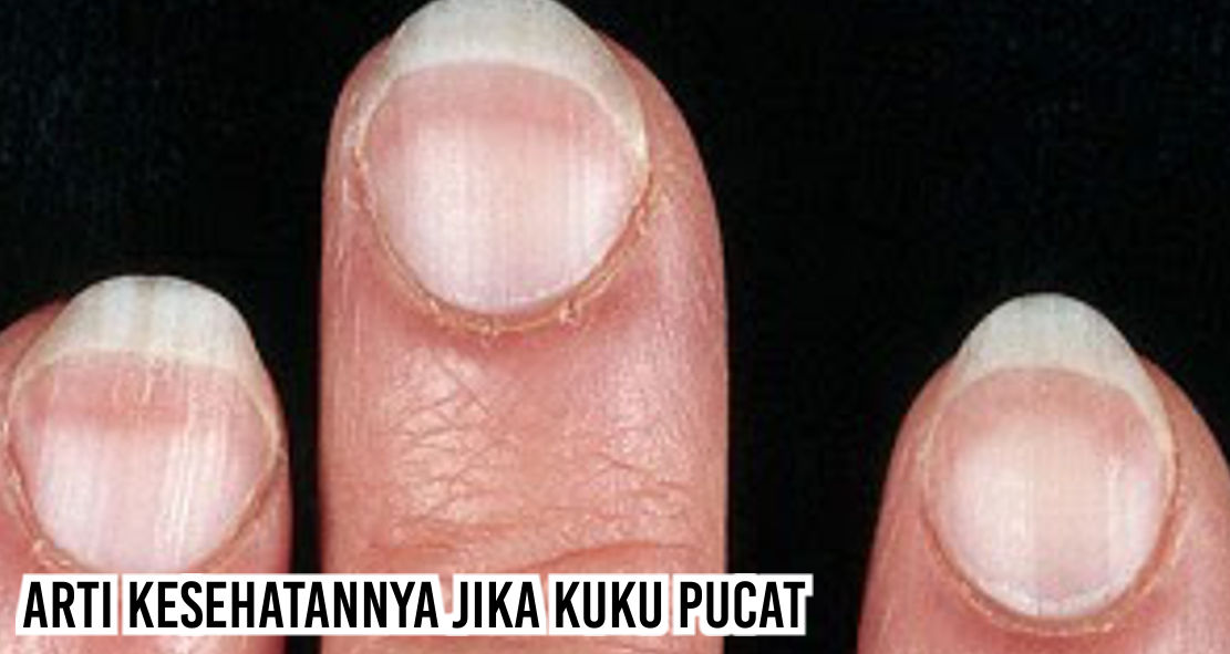 Ternyata Kamu Bisa Tahu Kesehatanmu Lewat Bentuk Dan Warna Kuku Lho !