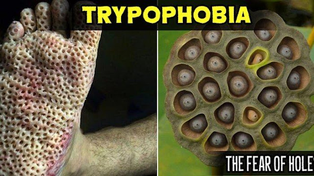 Apakah Anda Takut Lubang ? Coba Trypophobia Test