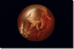 Pikir dulu gan sebelum malakukan MAKSIAT / ABORSI !! &#91;PIC&#93;