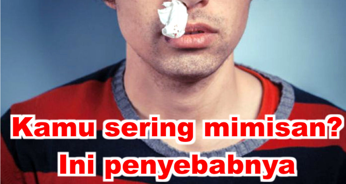  Ternyata Ini Penyebab Kamu Sering Mimisan !