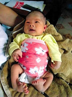 Bayi-bayi dengan Keanehan paling Ajaib di Dunia 