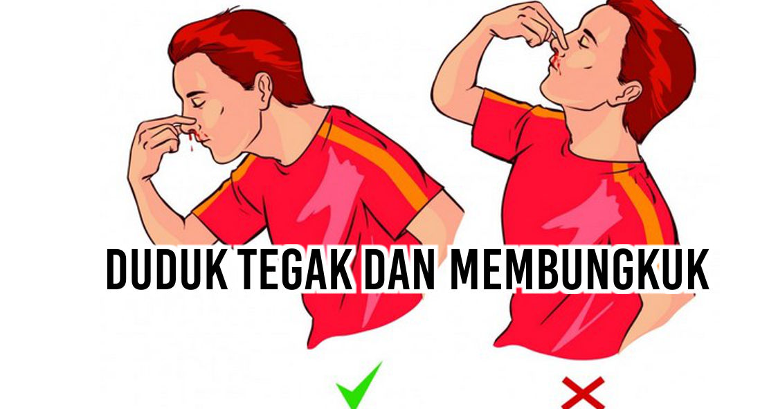  Ternyata Ini Penyebab Kamu Sering Mimisan !