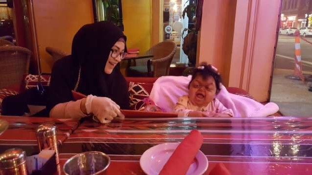 MASYA ALLAH ! Kesabaran Suami Istri Rupawan dan Anaknya yang Tuli &amp; Buta