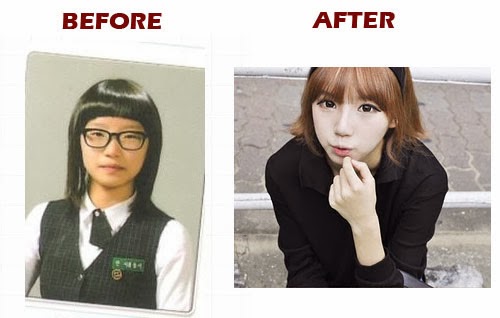 Supervenus, Apa Aja Sih Proses Operasi Plastik Buat Bikin &quot;Cantik&quot; Itu?