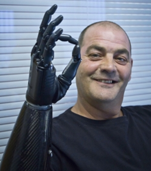 &#91;HOT&#93; &quot;Bebionic3&quot;, Si Robot Tangan Mirip Manusia