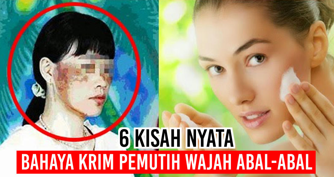  6 Bahaya Nyata Jika Menggunakan Krim Pemutih Palsu !