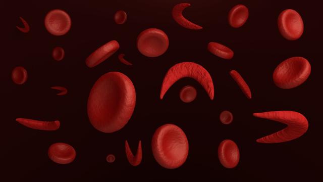 6 Jenis Penyakit Anemia yang Umum Terjadi