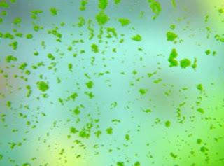 PENYEBAB MUNCULNYA ALGA AQUASCAPE
