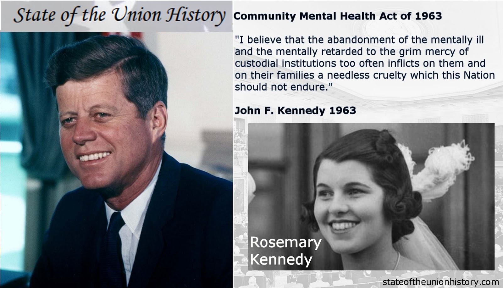 Rahasia Kelam Keluarga Kennedy, Prosedur Lobotomi Rosemary Kennedy