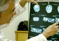 Cetak Organ Manusia Menggunakan Gel Dan Sel Induk