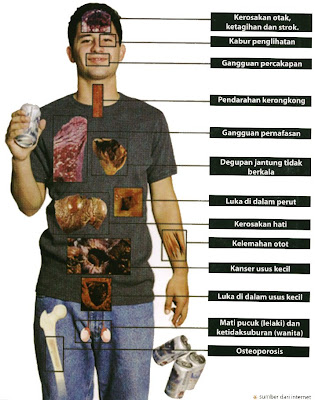 &#91;Share pengalaman / Diskusi&#93; Gaya Hidup Alcoholic lifestyle