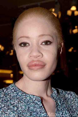 Connie Chiu: Model albino dari Cina
