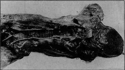 Misteri Manusia Super yang Bisa Mengeluarkan Api