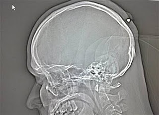 Ini Gan 7 Hal yang Mustahil tapi Nyata !