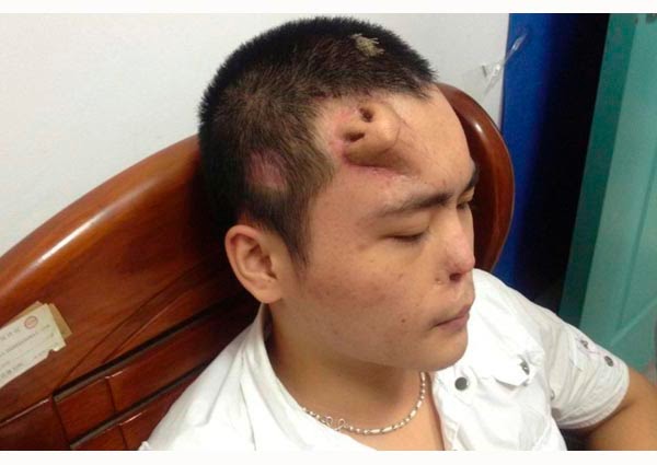 bentuk-hidung-dianggap-mencerminkan-kepribadian-ini-5-di-antaranya