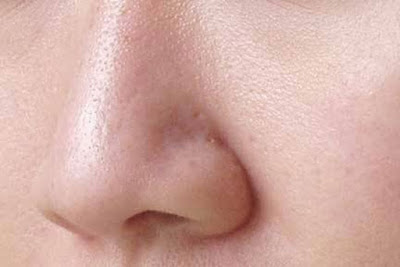 5 Fakta Bawang Putih Bikin Cantik Wanita Indonesia