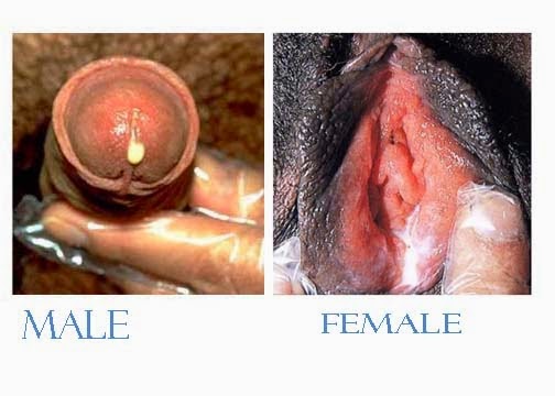 Obat sipilis/ raja singa/gonore/kencing nanah herbal manjur sembuh sampai tuntas