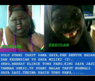 Gimana kalo agan liat iklan yang kayak gini 