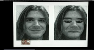 Prosopagnosia, Fenomena Tak Dapat Mengenali Wajah