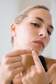 Tips agar jerawat tidak bertambah parah.