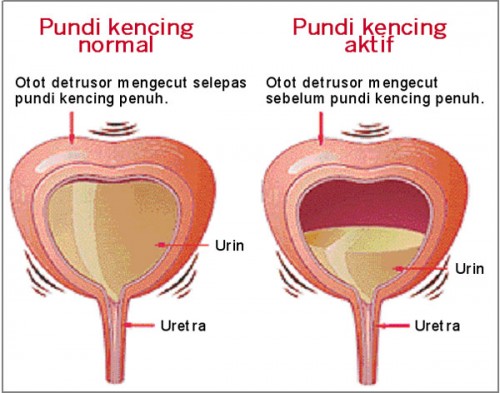 Jangan Sering Menahan Kencing, Ini Dia Bahayanya