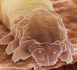 MENGERIKAN! Demodex, mahluk penghuni wajah manusia.