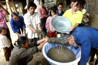 Pria Yang Tidak Pernah Mencuci Rambutnya Selama 26 Tahun...